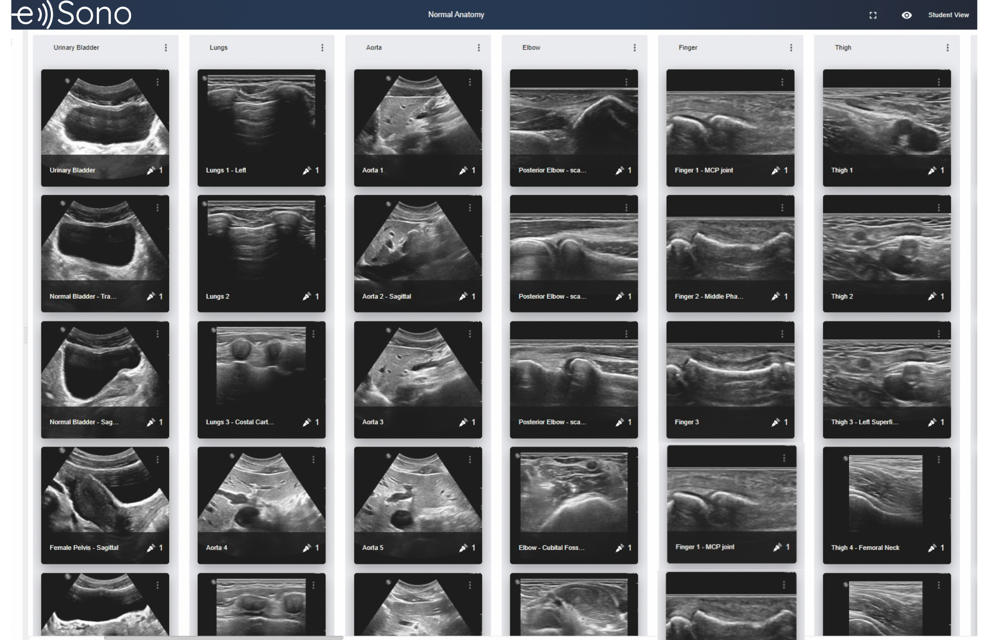 e Sono ultrasound simulation provided by Echo Healthcare